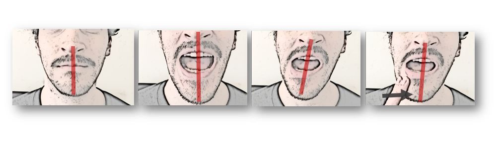 Guided Opening – Orofacial Pain and Oral Medicine Center